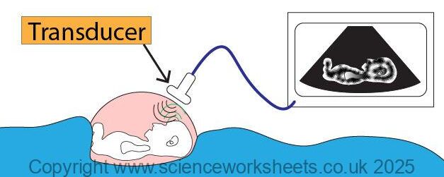 Transducer of ultrasound being placed on pregant female for an ultrasound scan