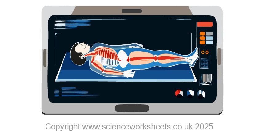 Gamma camera scan of the body