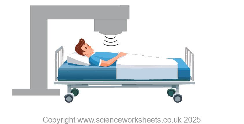 Radiotherapy treatment