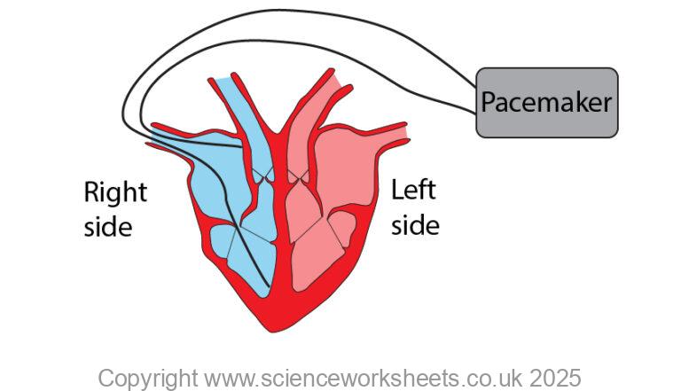Heart Pacemaker Gcse AQA GCSE Rate of blood flow (Biology) - Science Worksheets