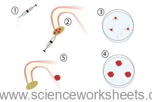 AQA GCSE Using hormones to treat infertility (Biology) - Science Worksheets