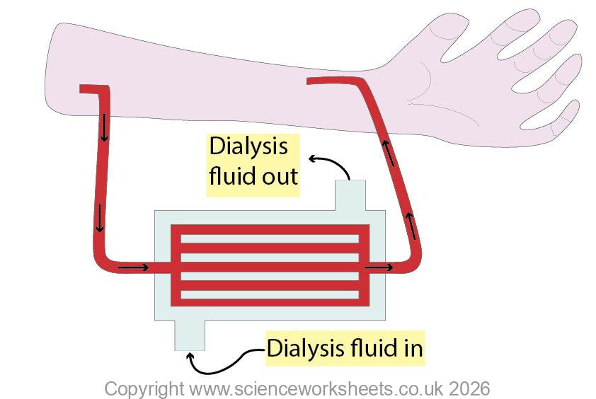 How dialysis works