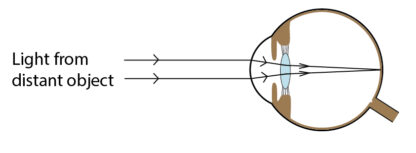 Long Object Focus Example AQA GCSE The Eye (Biology) - Science Worksheets