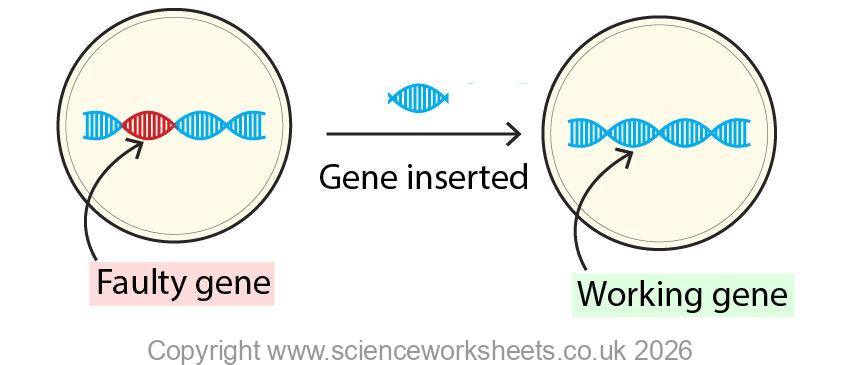 Gene therapy